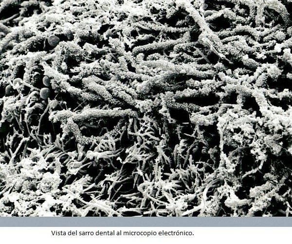 Imagen al microscopio electrónico de barrido de todo lo que compone el sarro y la placa en los dientes de los perros. Aparte de un montón de suciedad, hay una cantidad ingente de bacterias pululando en la zona.